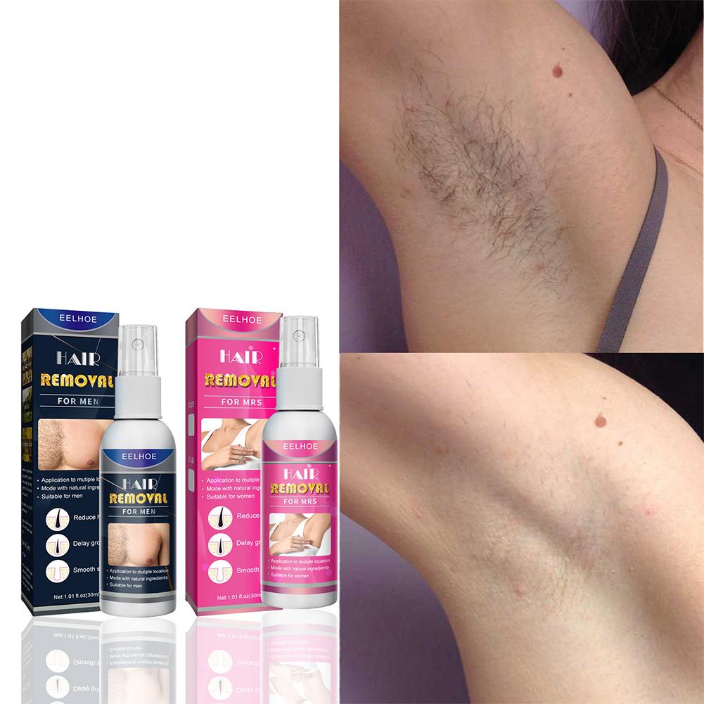 1/2PCS Super Natürliche Schmer – Hair Care Lotion Bewertung und Preis