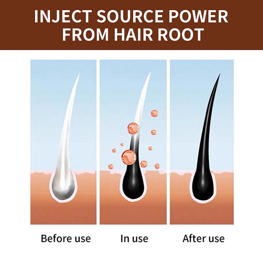 Natürliche Polygonum-Handseife – Hair Care Dandruff Bewertung und Preis